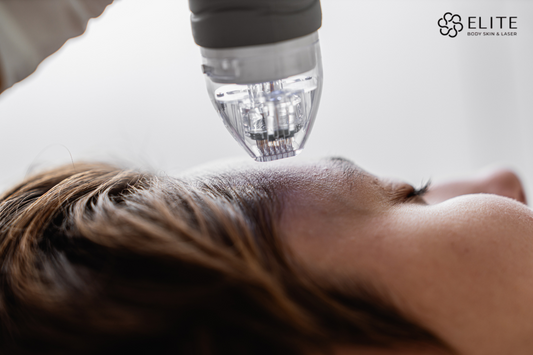 Microneedling clinic in chilliwack