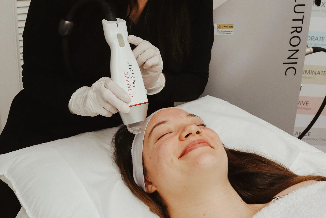 Woman Receiving RF Microneedling Treatment