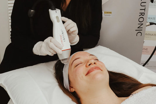 Your Comprehensive Guide to Understanding Microneedling