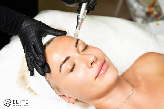 microneedling treatment in Chilliwack
