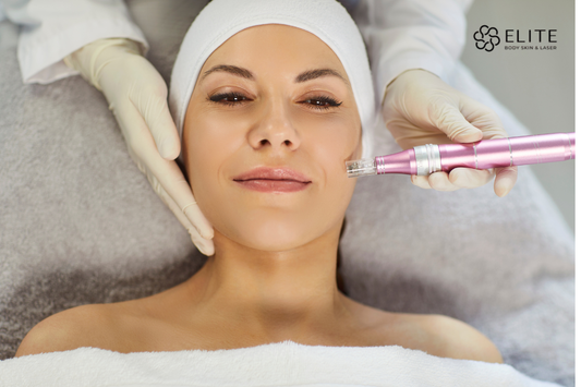microneedling treatment in Chilliwack