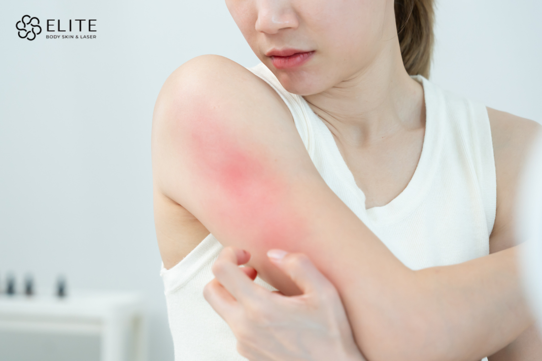 Skin Texture Problems