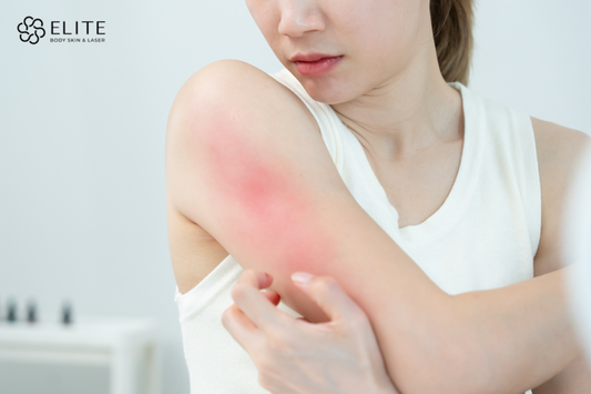 Skin Texture Problems