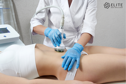 Skin Tightening Treatments Chilliwack