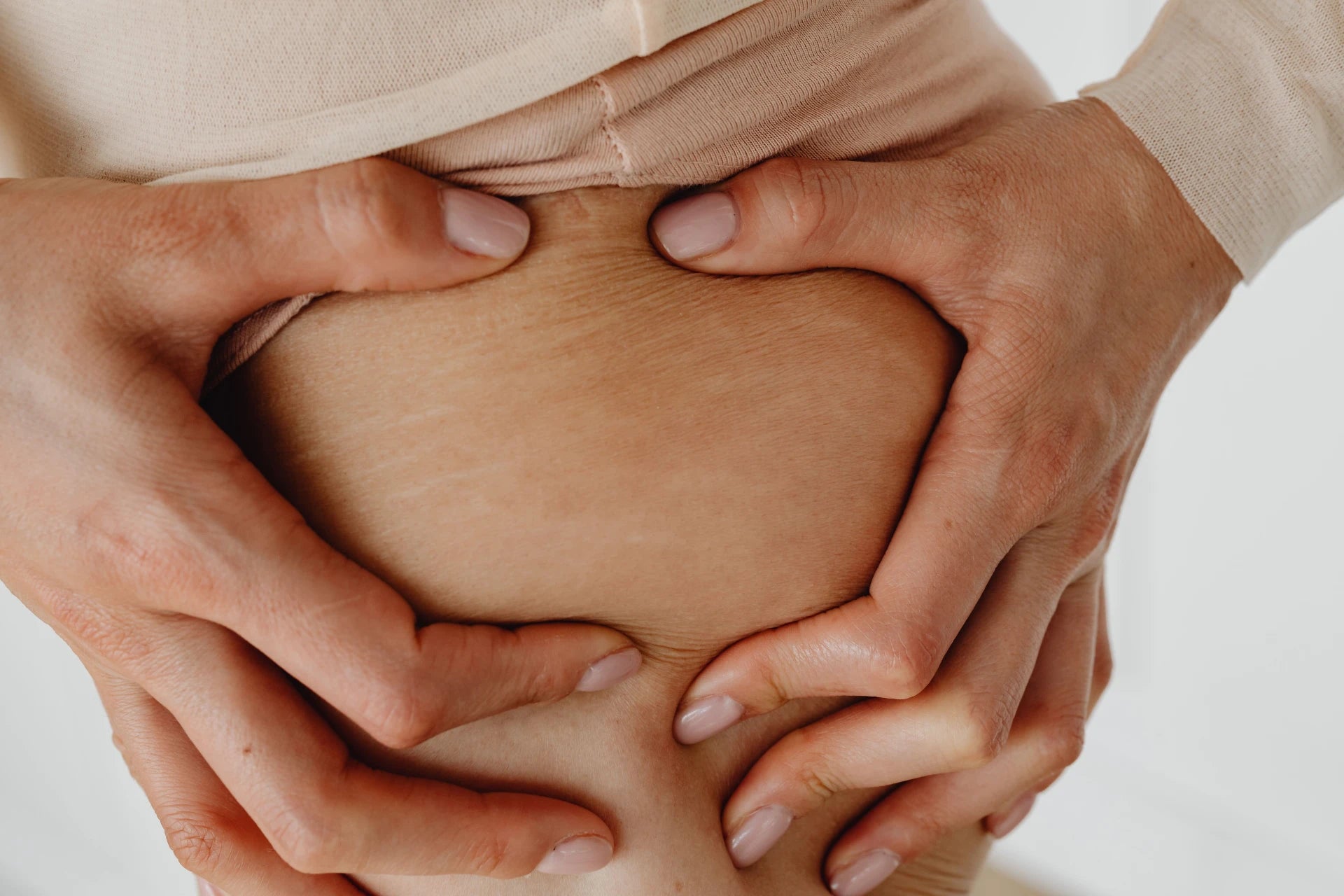 Woman with cellulite on the hip