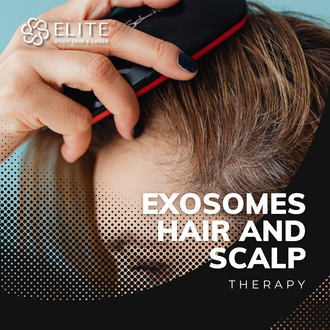 Exosomes Hair and Scalp Therapy