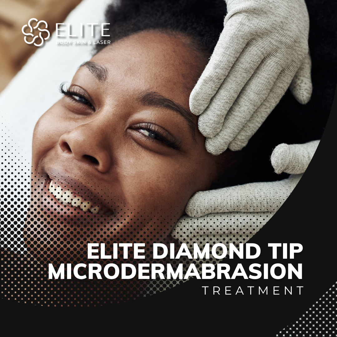 Elite Diamond Tip Microdermabrasion Treatment