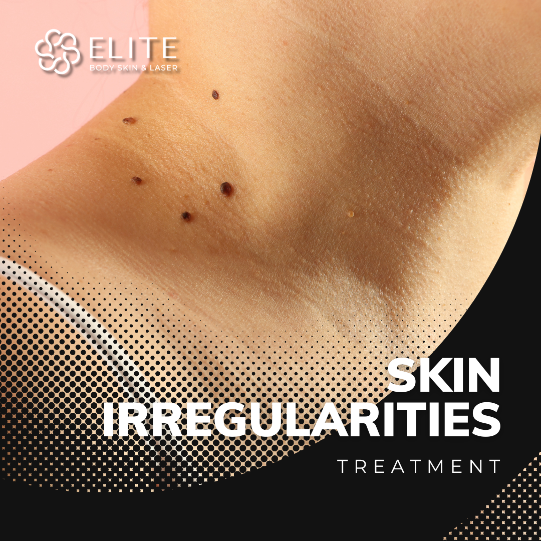 Skin Irregularities