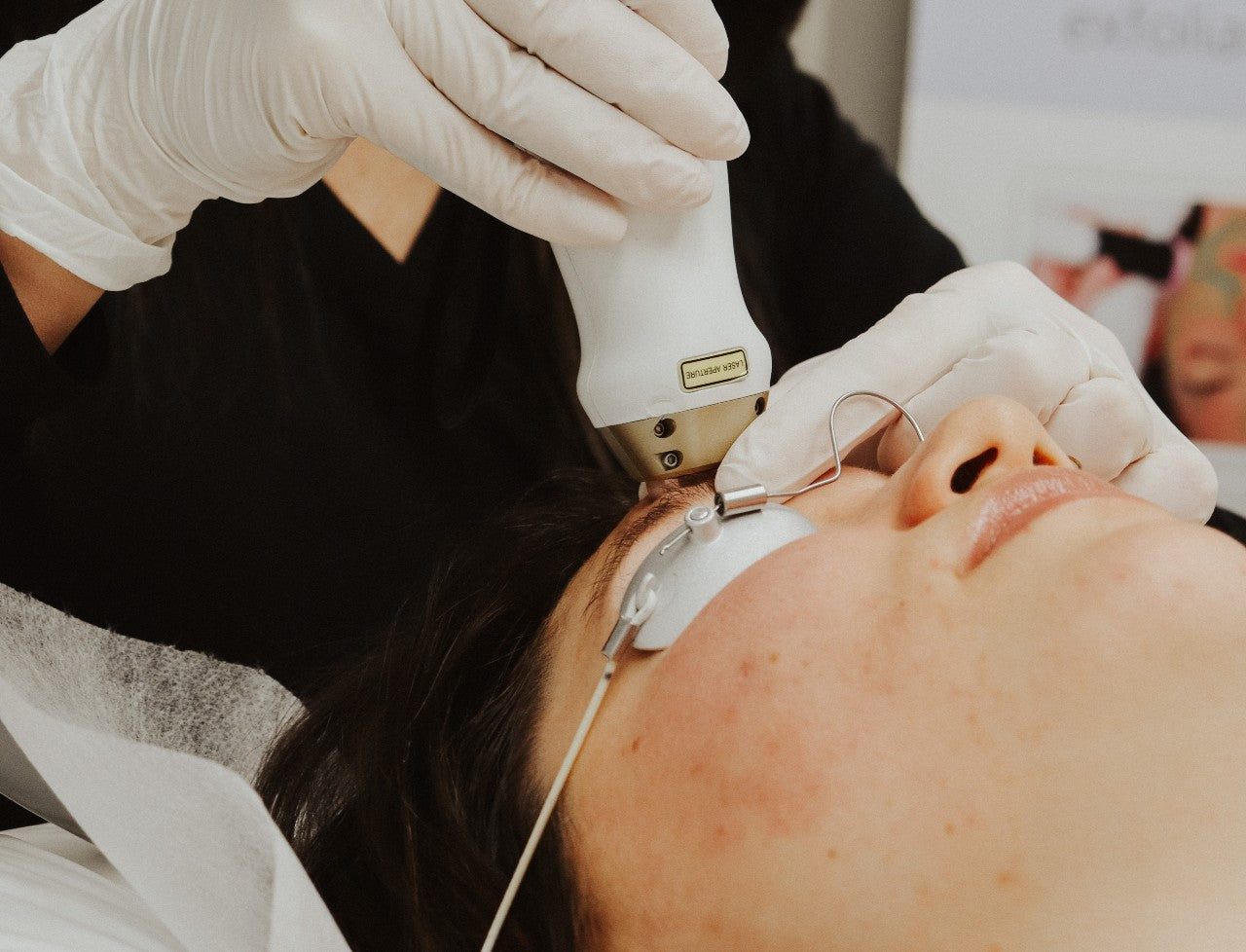 Woman receiving photofacial treatment